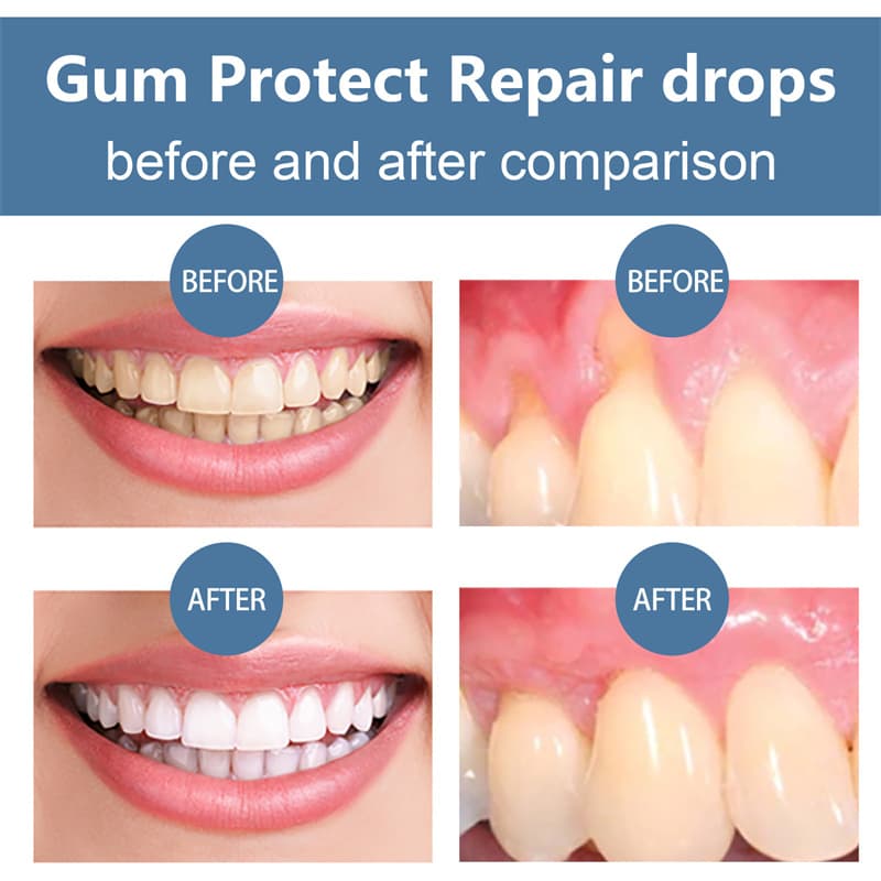 Fast Relief Gum Repair Serum for Sensitive Teeth & Stronger Daily Gum Care image 3