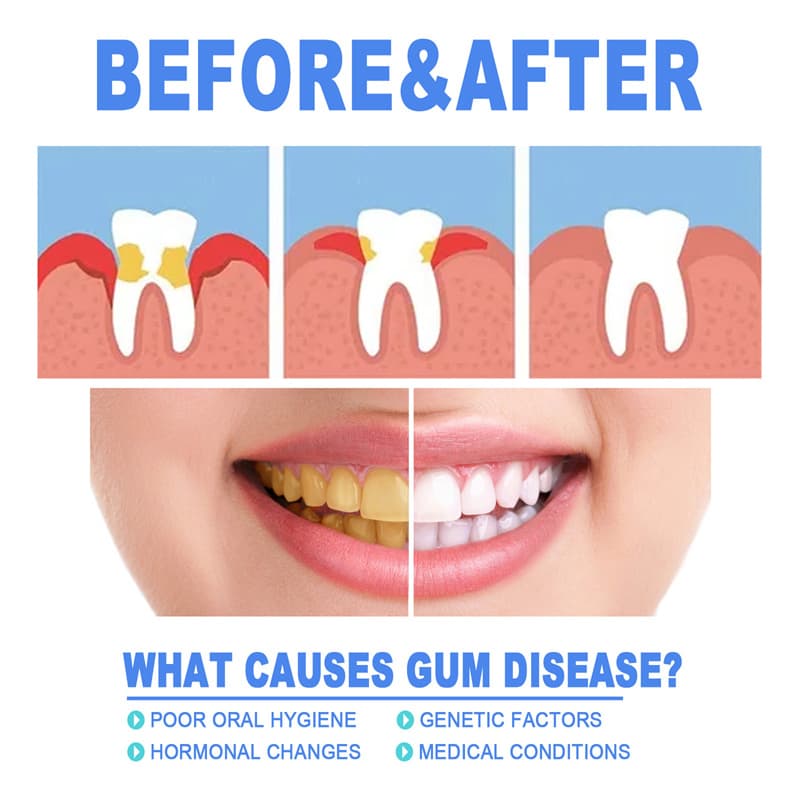 Fast Relief Gum Repair Serum for Sensitive Teeth & Stronger Daily Gum Care image 5