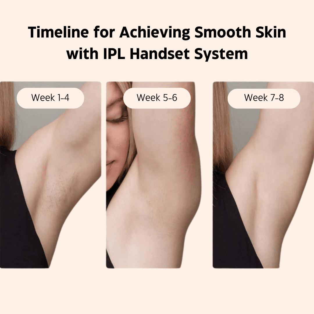 IPL Hair Removal Handset System – A Laser-Free Alternative image 5
