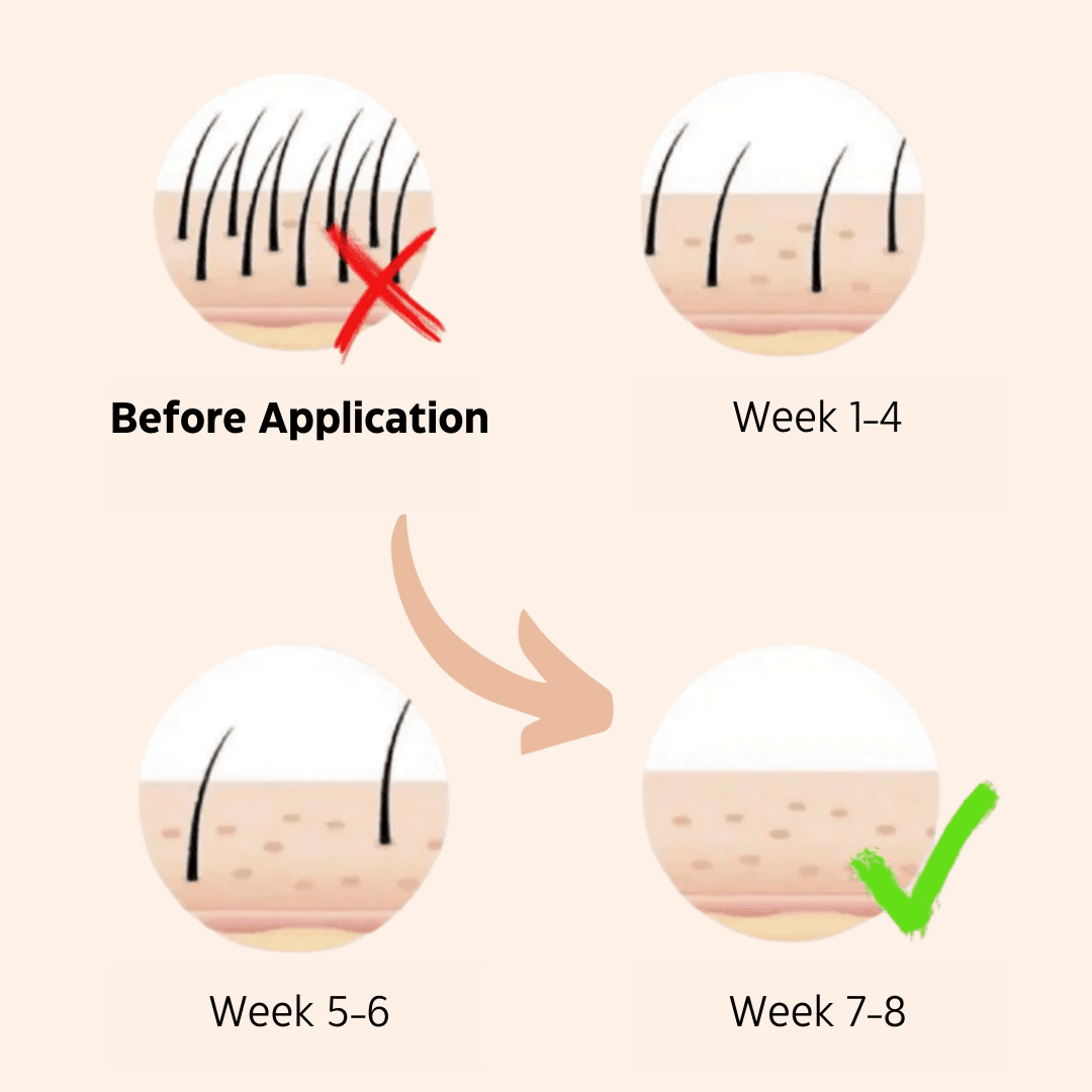 IPL Hair Removal Handset System – A Laser-Free Alternative image 8