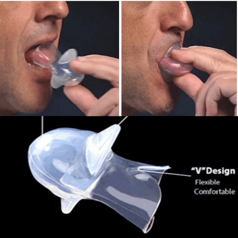 Medical Anti Snore Device Silicone Tongue Retainer for Better Sleep Quality image 5