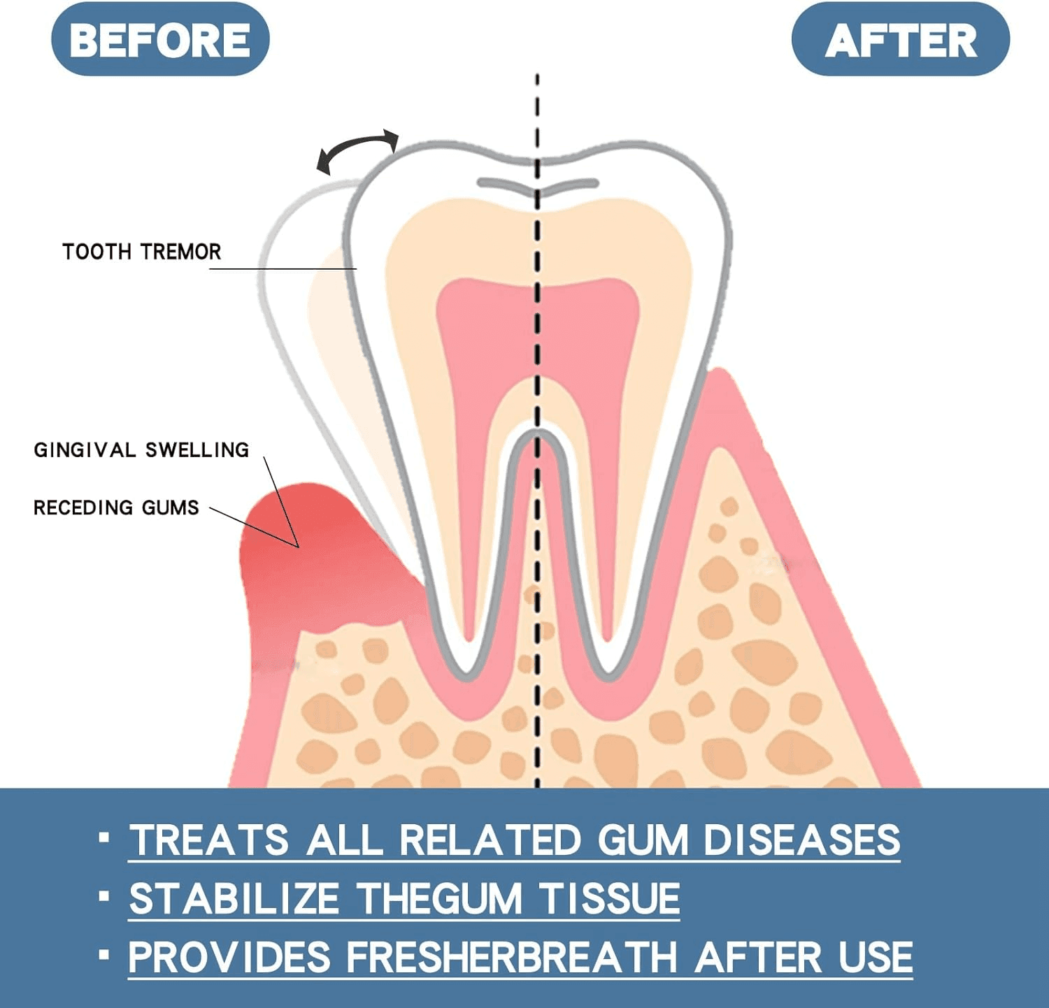 Rapid Repair Gums Serum, Instant Relief for Sensitive Teeth, Cavities & Gum Damage image 3