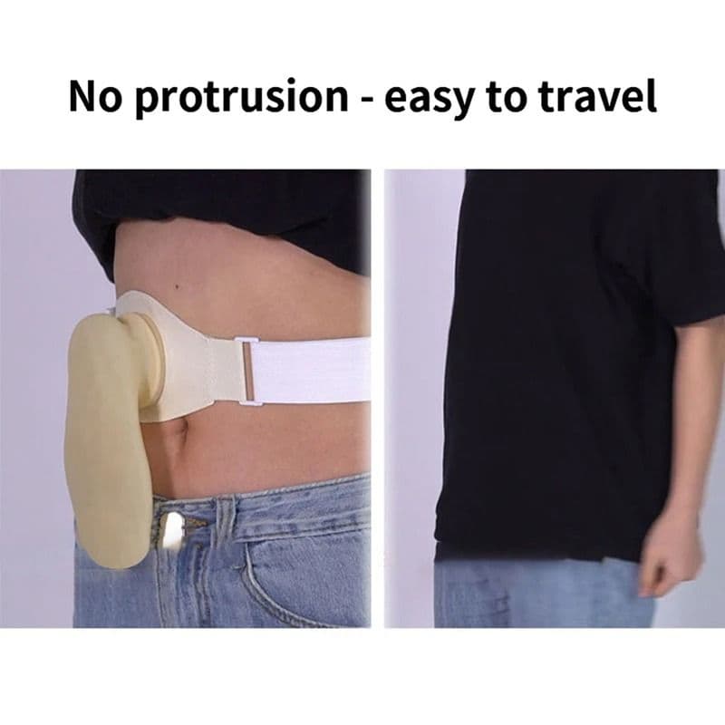 Silicone Colostomy Bags Ostomy Belt Drainable Urostomy Pouch After Colostomy Ileostomy image 6