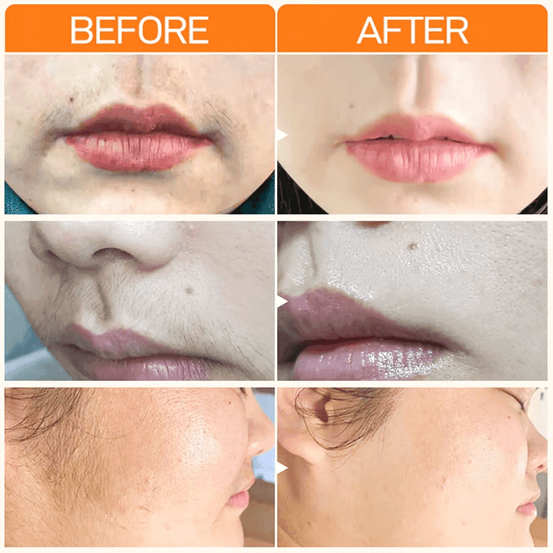 Hair Removal Cream for Women Depilatory Smooth Skin for Sensitive Areas image 3