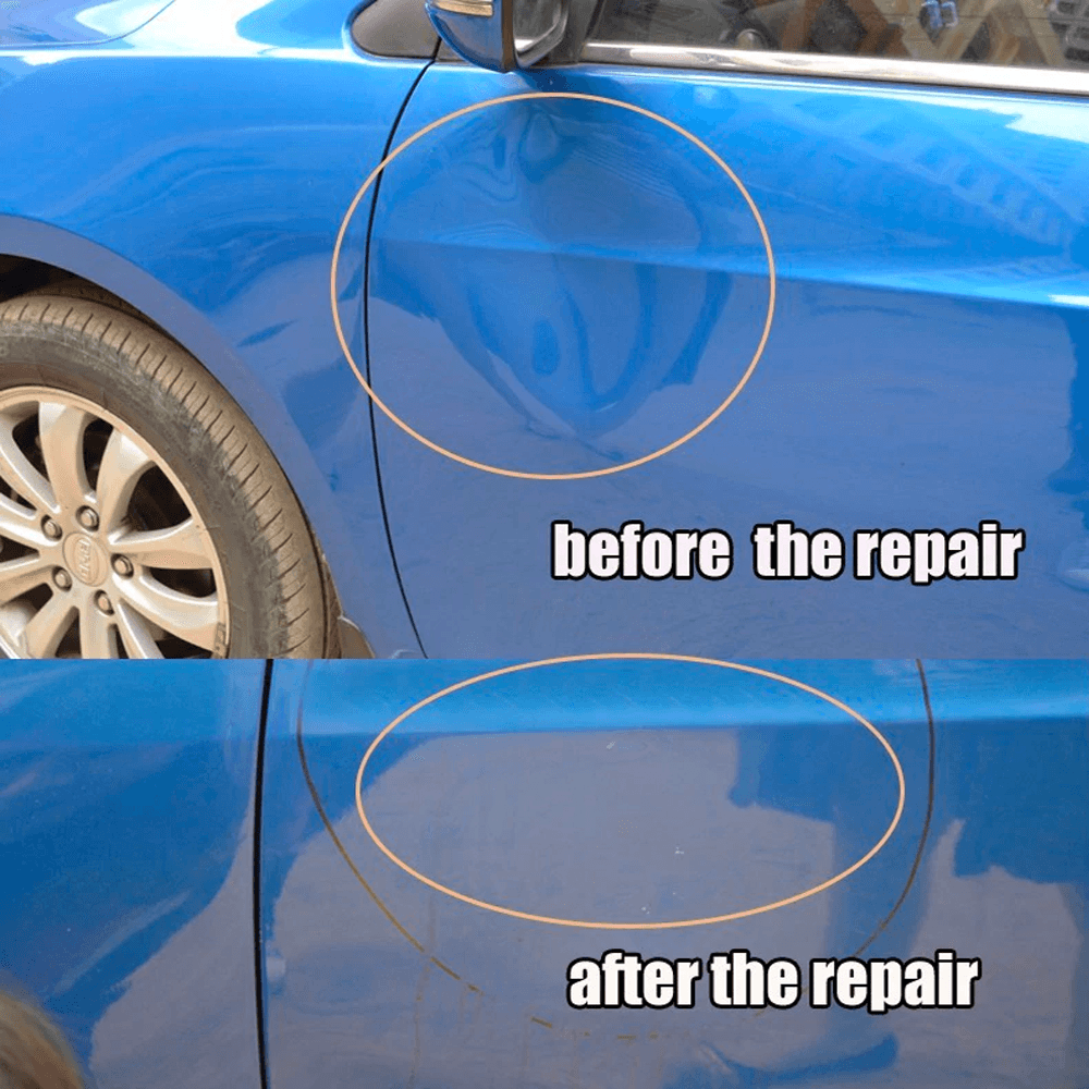 Easy DIY Car Dent Removal Kit Complete Car Dent Repair Tools image 3